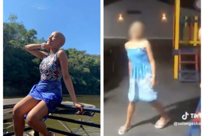 adolescente-com-sequelas-de-cancer-e-alvo-de-bullying-por-colega-de-escola